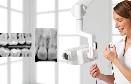 Dental X-ray